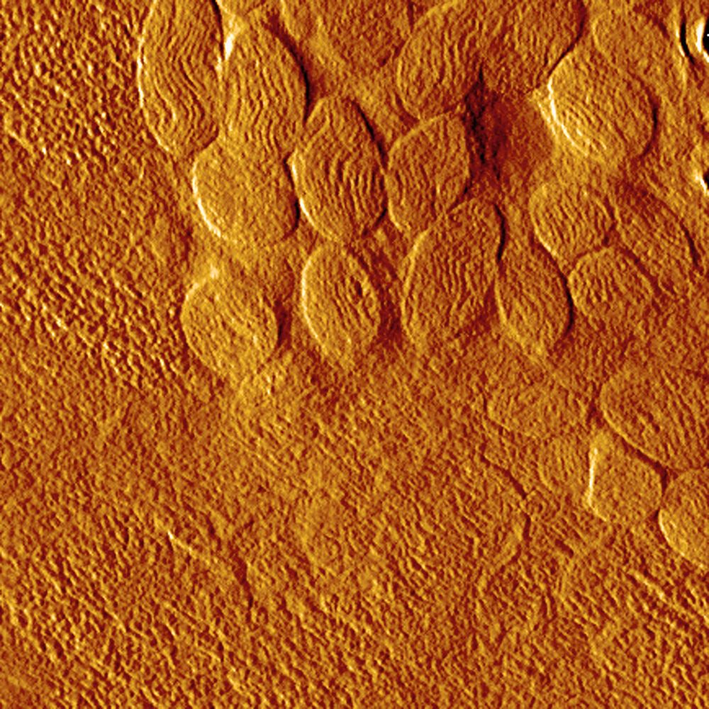 AFM amplitude image of the muscle of cat‘s mite Otodectes cynotis