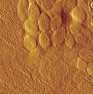 afm muscle