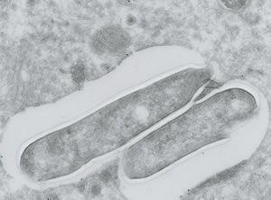 immuno diamond knife