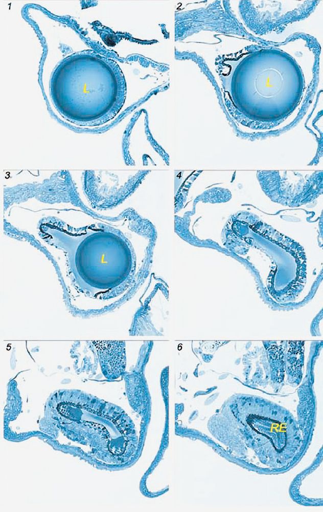 histo cryo