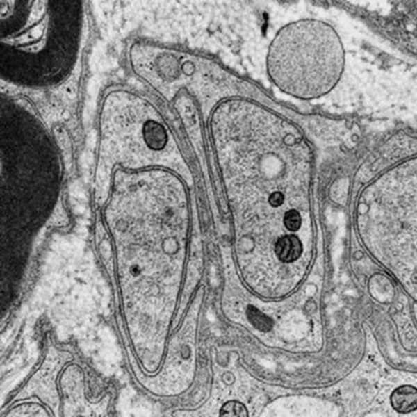 peripheral nerve (rat)